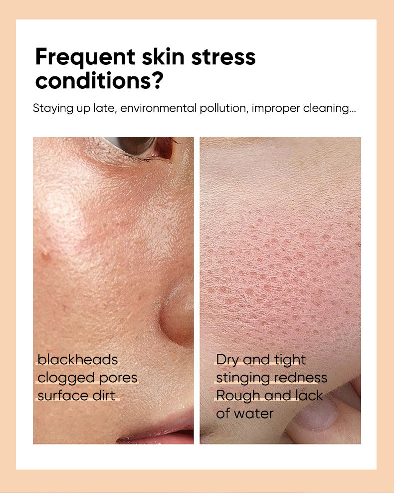 Glycolic Acid Essence Skin Care Acne Water Shrink Pores Facial Rejuvenation Original Solution Moisturizing Brightening