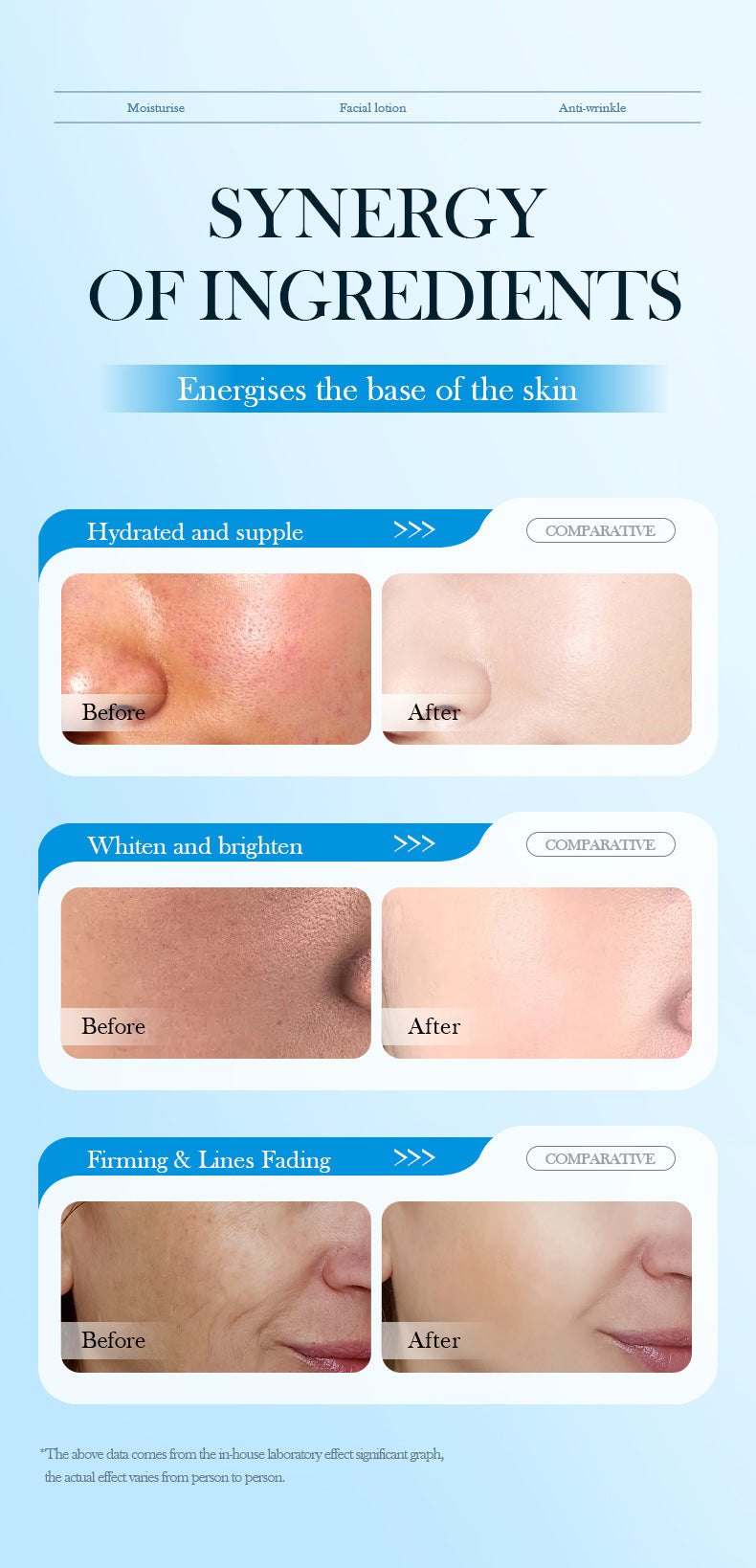 Full English Hyaluronic Acid Face Cream SADOER8D Anti-wrinkle Hydrating Nourishing Face Cream Moisturizing and Rejuvenating  Foreign Trade Wholesale