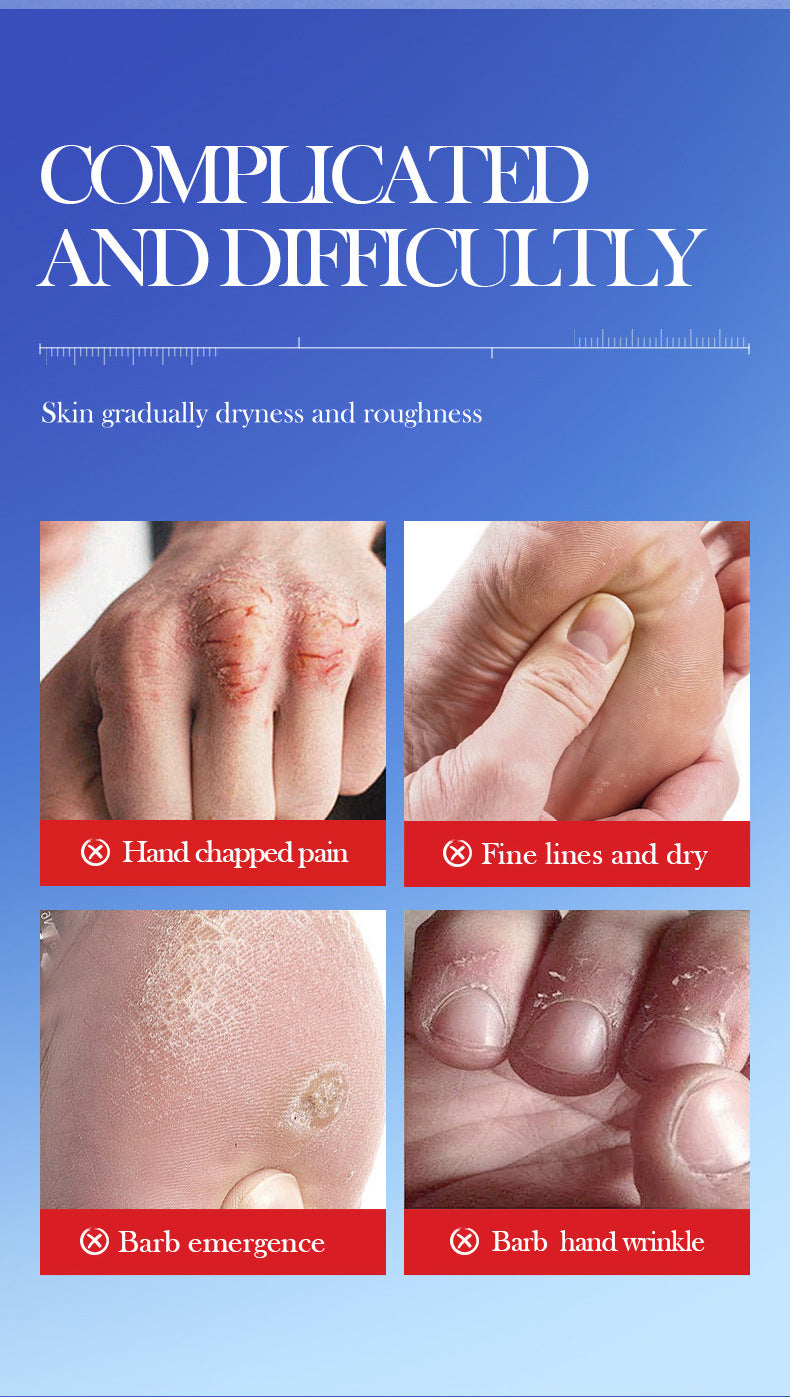 Urea Hand and Foot Care Cream FAYANKOU Moisturizing and Hydrating Hand Cream Cross-Border Wholesale