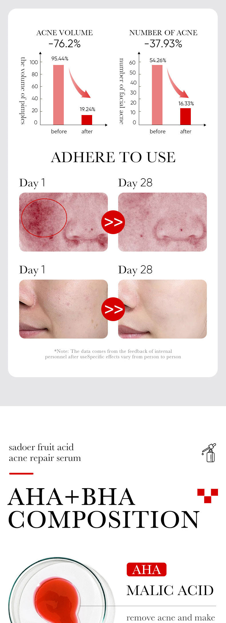 Anti-acne Serum SADOER Fruit Acid Fades Acne Marks, Hydrates and Moisturizes, Cross-Border Wholesale
