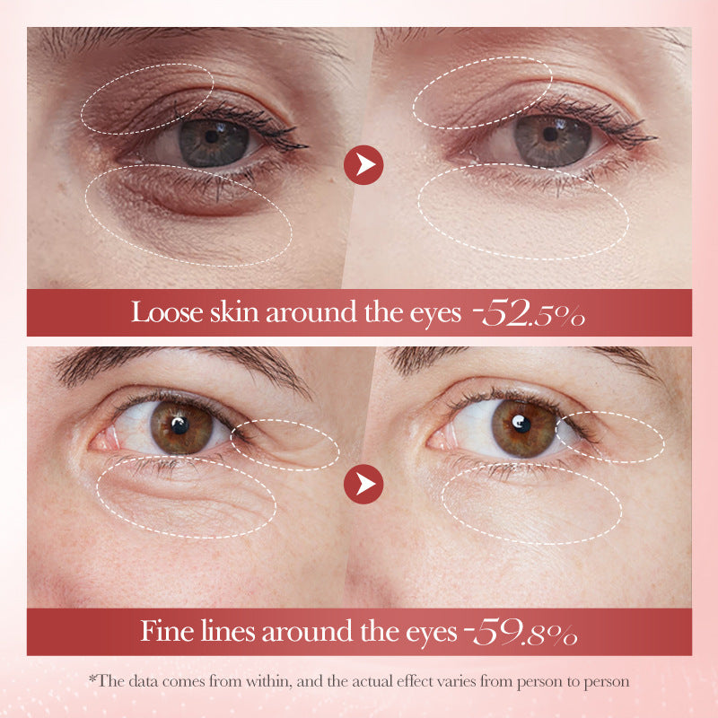 Snail Moisturizing Eye Cream BIOAOUA Hydrating and Moisturizing Eye Cream for Cross-Border Wholesale