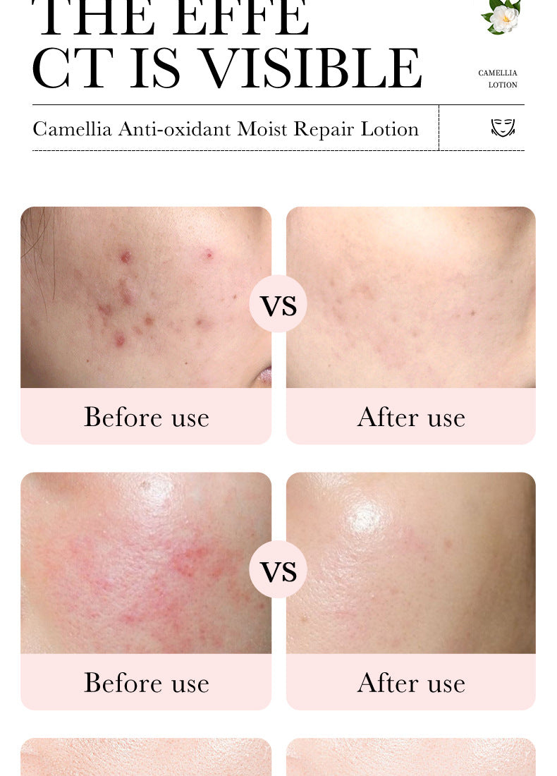 Camellia Lotion100ml BIOAOUA Moisturizing and Hydrating Body Lotion Cross-Border Wholesale