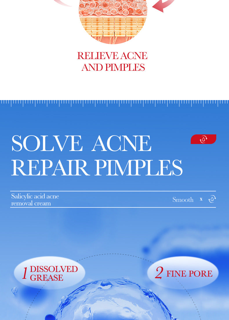 Full English Cream BIOAOUA Salicylic Acid Moisturizing Hydrating Fading Acne Marks  Wholesale