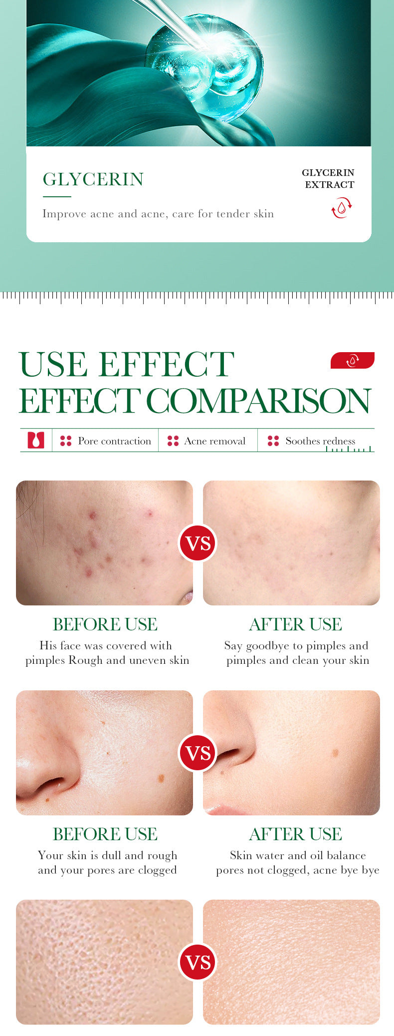 Full English Essence Serum35ml BIOAOUA Salicylic acid moisturizing and hydrating  wholesale