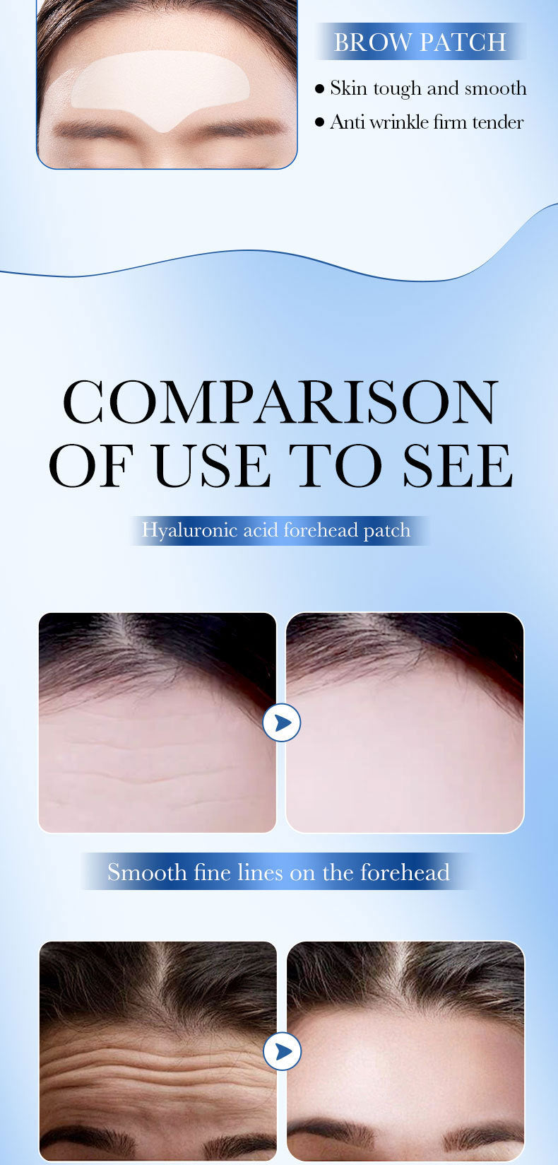 Full English Hyaluronic Acid Forehead Patch SADOER Collagen Firming Improves Forehead Wrinkles  Wholesale