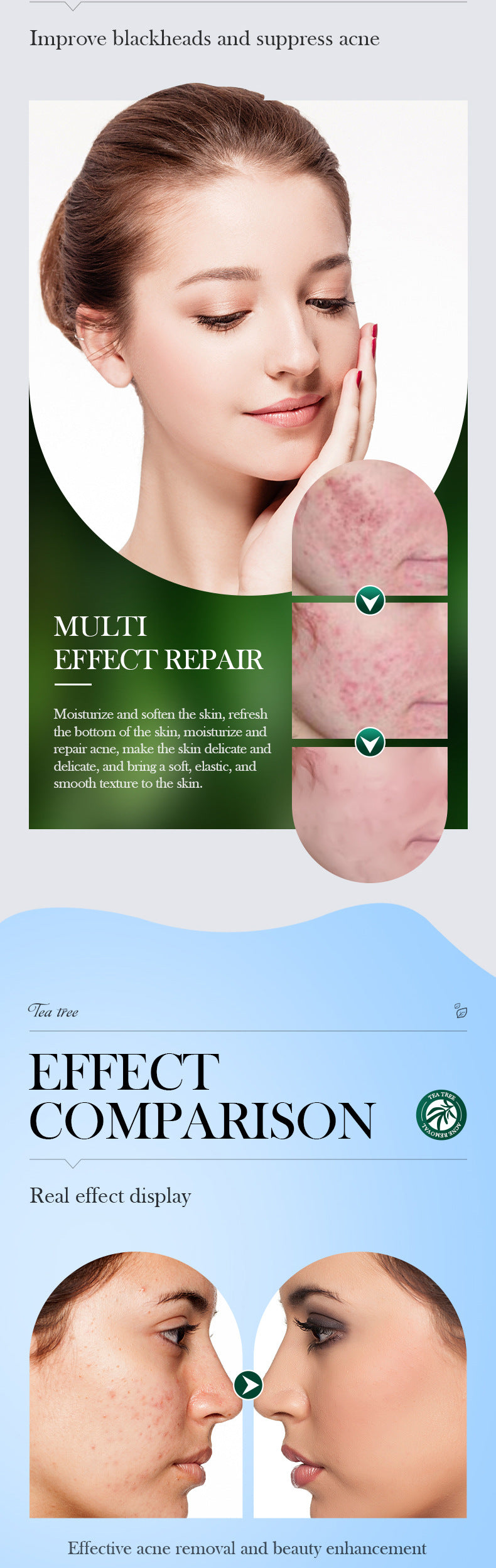 Full English Tea Tree Skincare Set SADOER Cleansing, moisturizing, hydrating five-piece set for  foreign trade wholesale