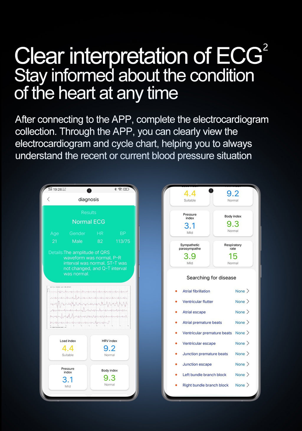 S25Pump Blood Pressure Watch Blood Sugar Blood Oxygen Bluetooth Call Heart Rate Blood Oxygen Monitoring Pump Blood Pressure Watch