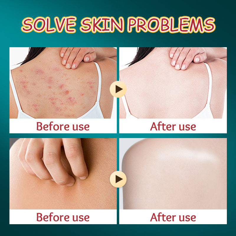 Cross-Border Christmas Stocking Bath Bombs SADOER Deep Cleansing Body Bath Bath Salts Export Manufacturer Wholesale