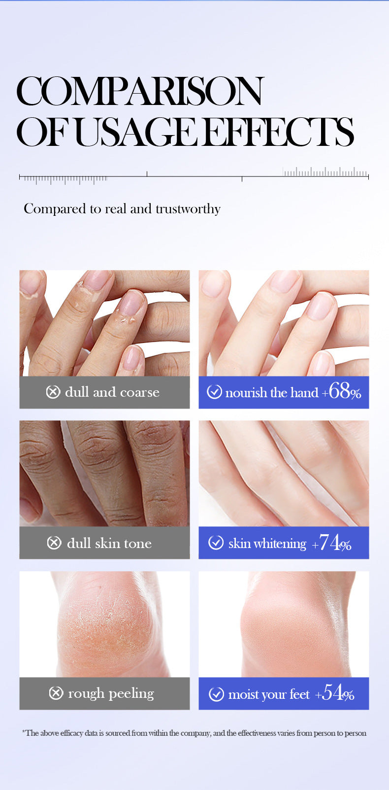 Urea Hand and Foot Care Cream FAYANKOU Moisturizing and Hydrating Hand Cream Cross-Border Wholesale