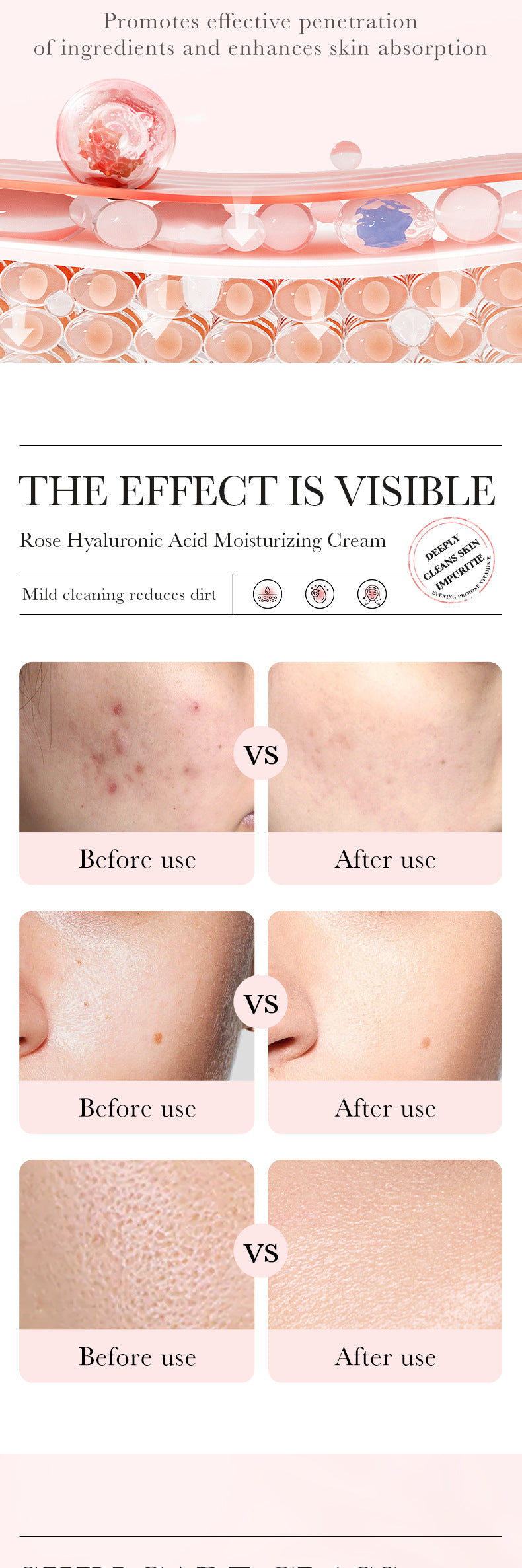 Rose Hyaluronic Acid Skincare Set Hydrating, Cleansing, Moisturizing, and Skin Rejuvenation Six-Piece Set Wholesale from Foreign Trade Manufacturer