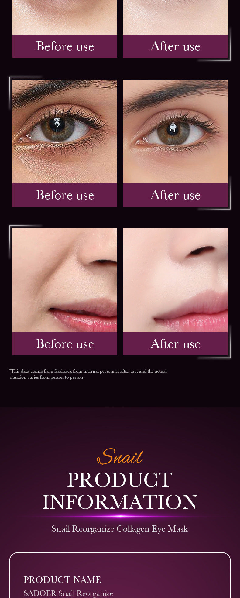 Snail Eye Mask SADOER Collagen improves dark circles, eye wrinkles, and eye bags cross-border wholesale