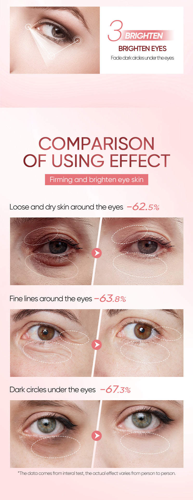 Niacinamide Rejuvenating Eye Cream BIOAOUA Moisturizing Eye Cream Cross-Border Wholesale