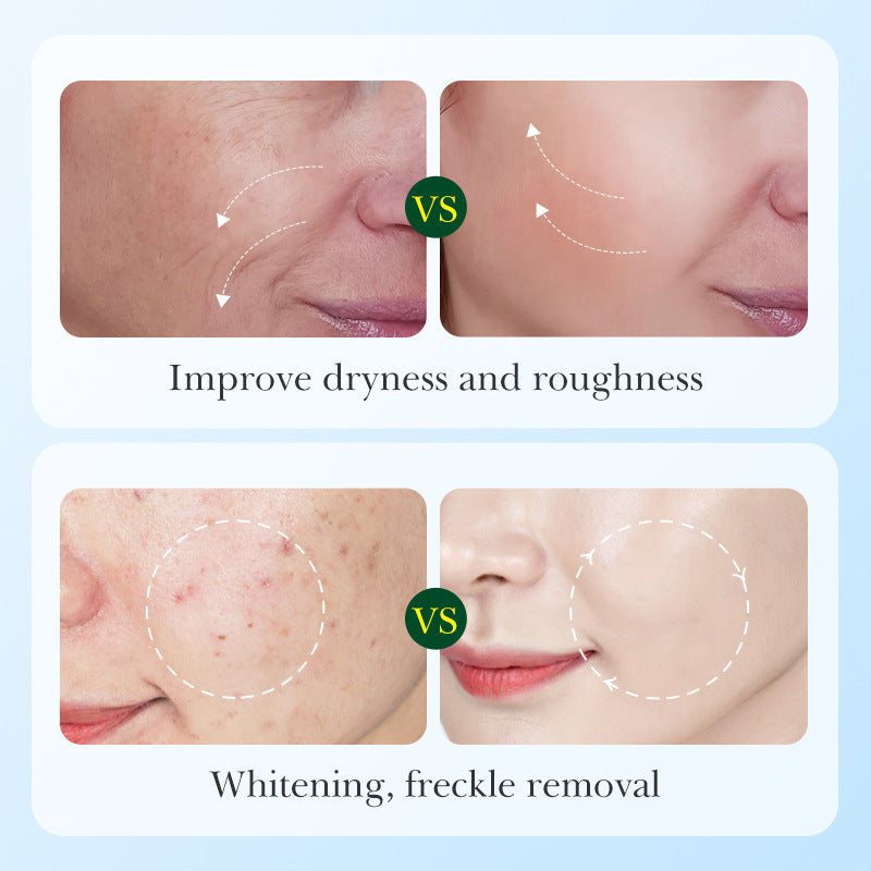 Licorice VC Skin care set SADOER Whitening, hydrating, skin rejuvenation, nourishing six-piece set for cross-border foreign trade wholesale