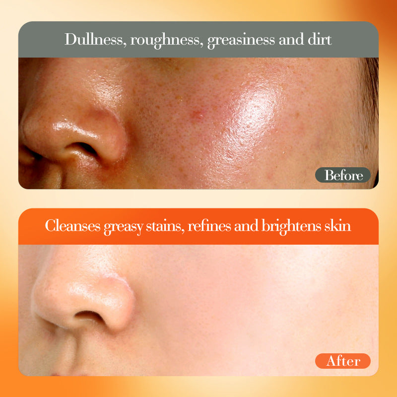 VC Whitening and Moisturizing Face Cream FAYANKOU Brightening and Moisturizing Essence Cream Cross-Border Wholesale