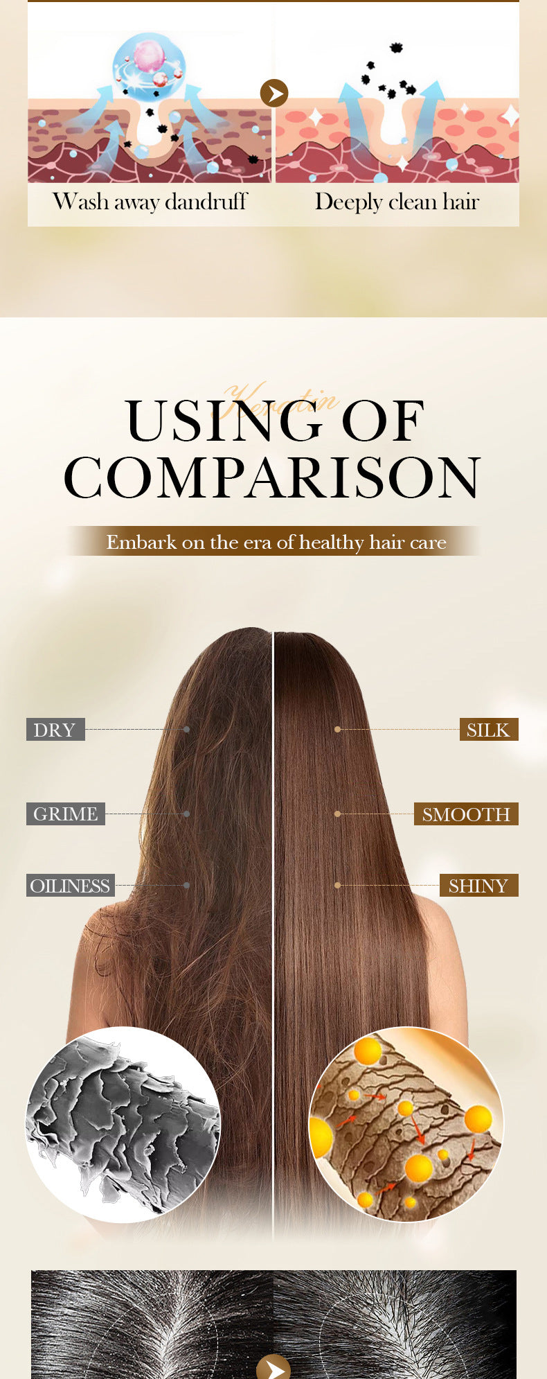 Keratin Peptide Anti-Dandruff Shampoo SADOER Fluffy Cleansing Shampoo Cross-Border Wholesale