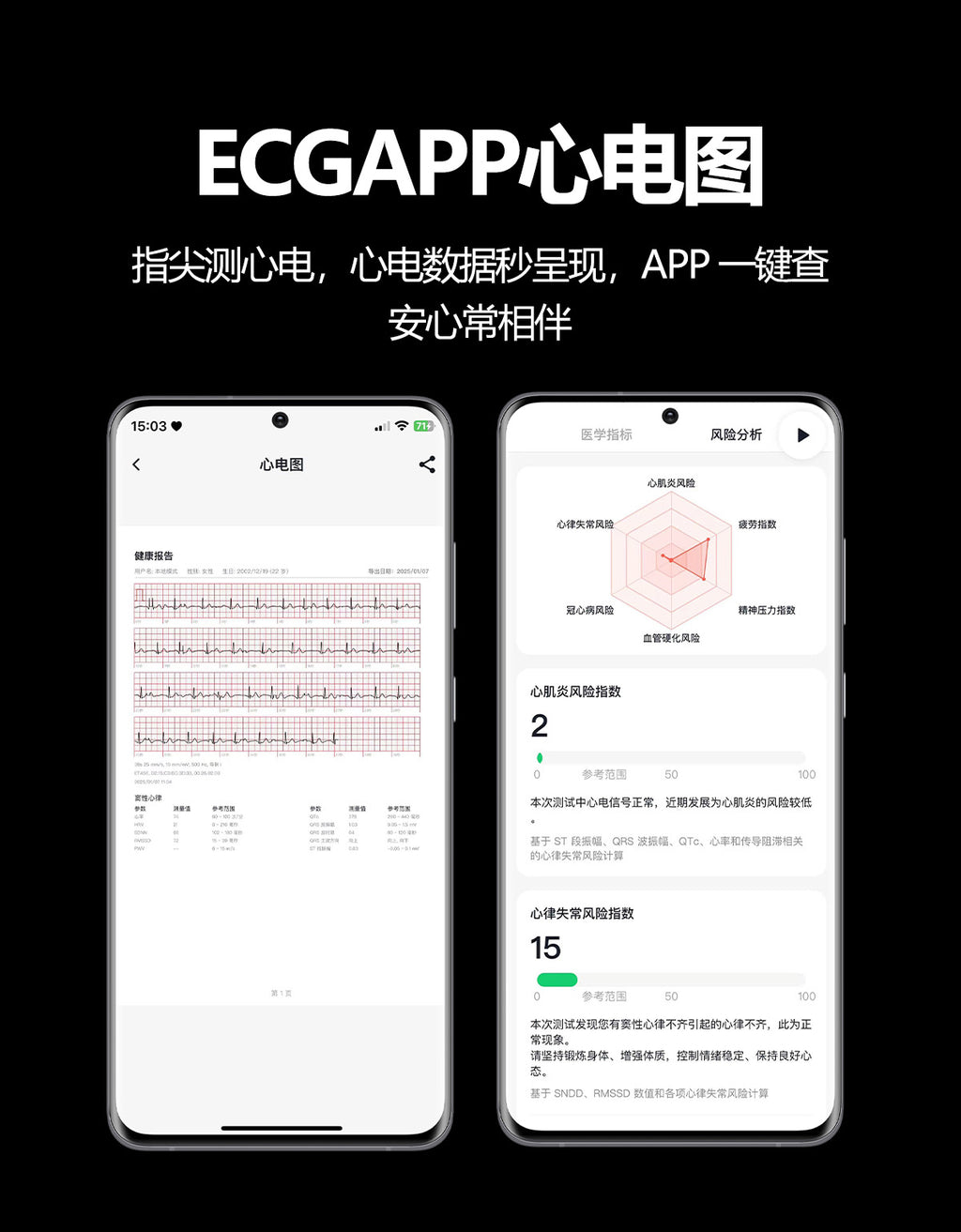 s101Smart Watch Air Pump Air Bag Blood Pressure Measurement ecg ECG NFC Bluetooth Call Blood Sugar Health Smart Watch