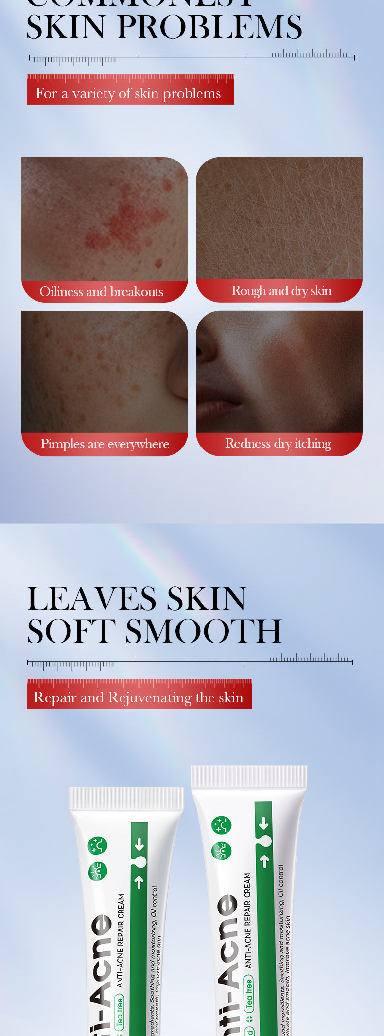 Cross-border Acne Treatment Cream20g Hydrating Moisturizing Anti-Acne Face Cream Wholesale from Foreign Trade Manufacturer