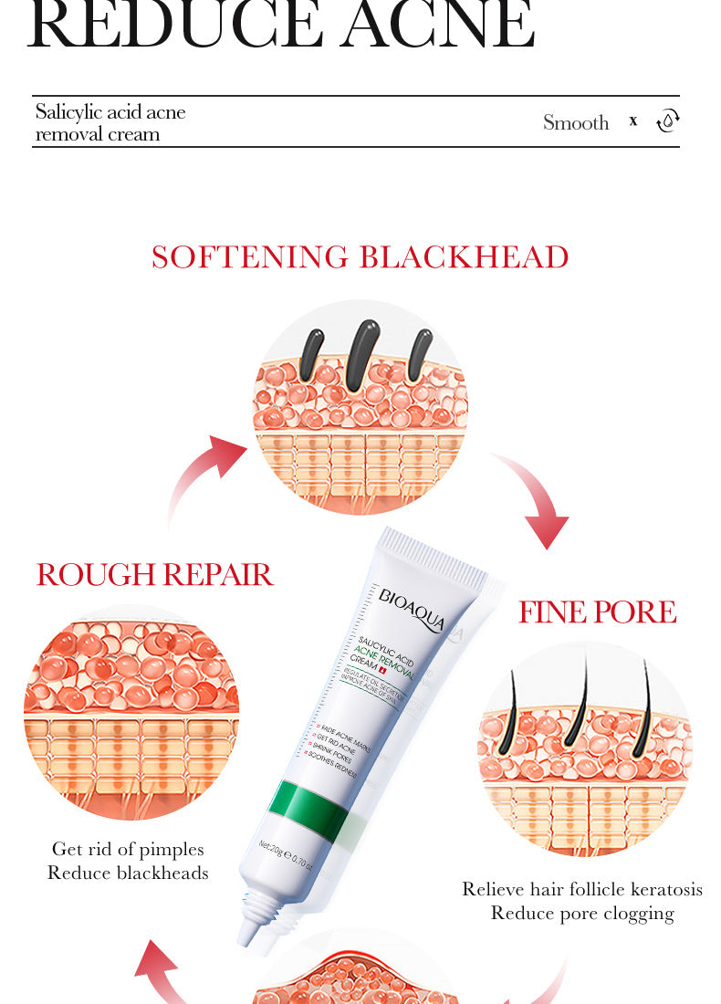 Full English Cream BIOAOUA Salicylic Acid Moisturizing Hydrating Fading Acne Marks  Wholesale