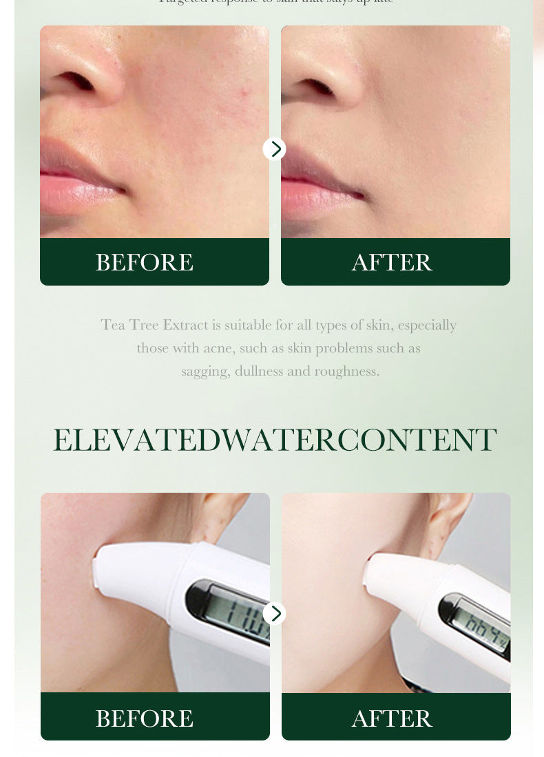 Full English Tea Tree Skincare Set SADOER Cleansing, moisturizing, hydrating five-piece set for  foreign trade wholesale