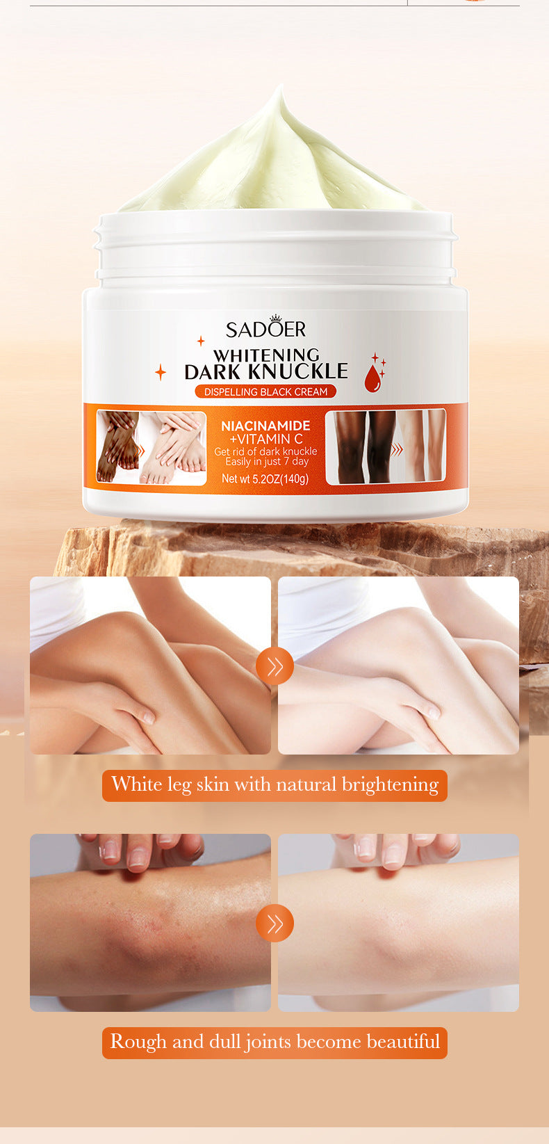 Full English Joint Whitening and Dark Spot Removal Cream140g SADOER Vitamin C Moisturizing Body Lotion  Wholesale