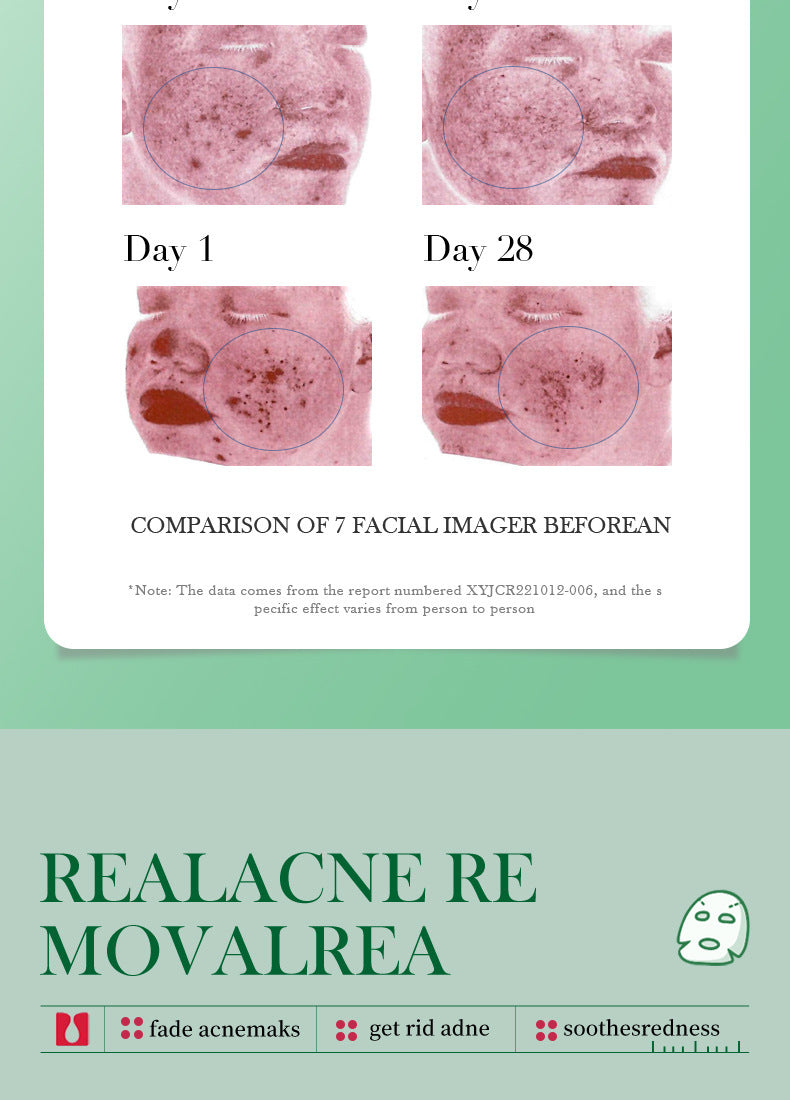 Salicylic Acid Series  BIOAOUA Pore Minimizing and Acne-Removing Mask   Factory Direct Sales