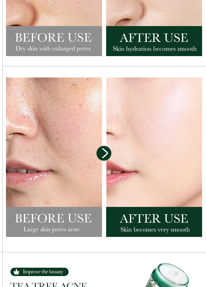 Full English Tea Tree Skincare Set SADOER Cleansing, moisturizing, hydrating five-piece set for  foreign trade wholesale