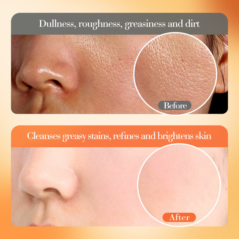 VC Whitening and Brightening Essence Lotion FAYANKOU Moisturizing lotion cross-border foreign trade wholesale