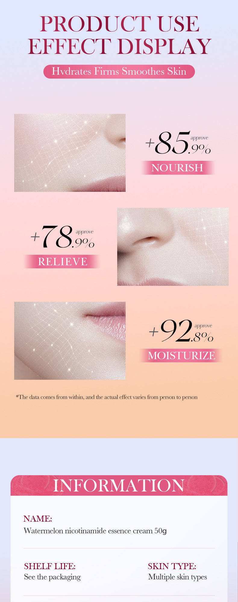 Watermelon Niacinamide Essence Lotion SADOER Skin rejuvenation moisturizing cream cross-border foreign trade wholesale