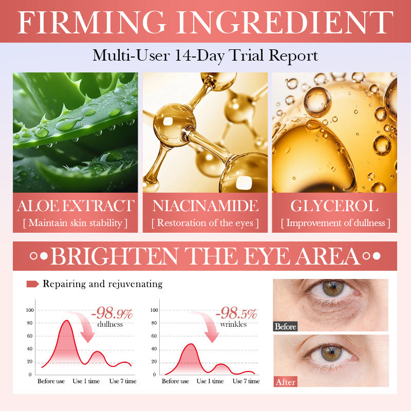 Watermelon Niacinamide Essence Eye Cream SADOER Moisturizing Eye Cream for Eye Area Wholesale Cross-Border Trade