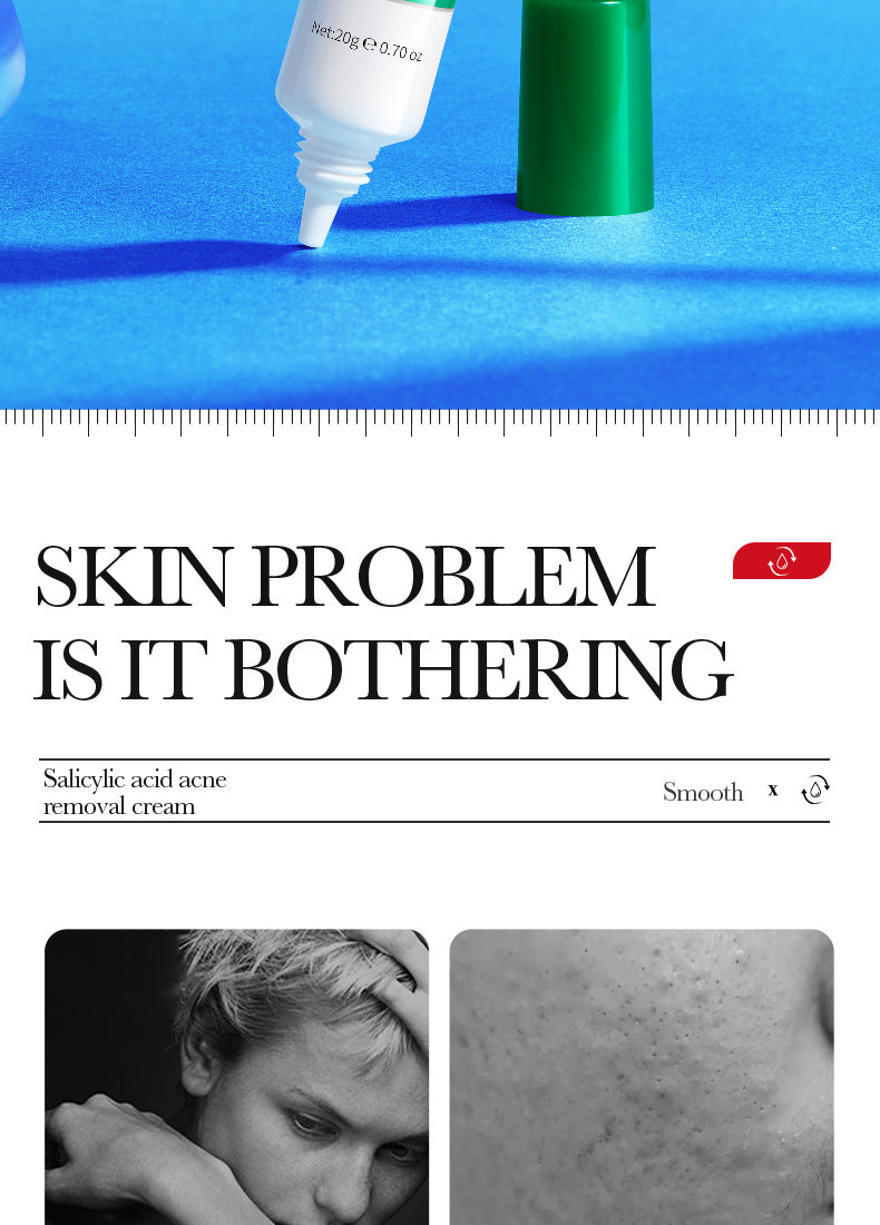 Full English Cream BIOAOUA Salicylic Acid Moisturizing Hydrating Fading Acne Marks  Wholesale