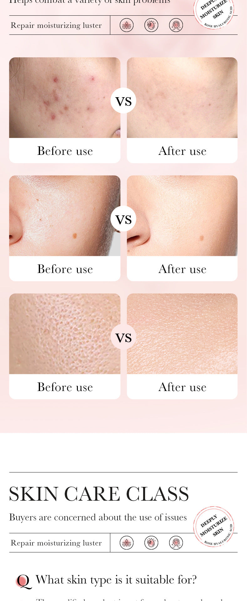 BIOAOUA Rose Hyaluronic Acid Moisturizing Six-piece Set Hydrating skin care product set  wholesale