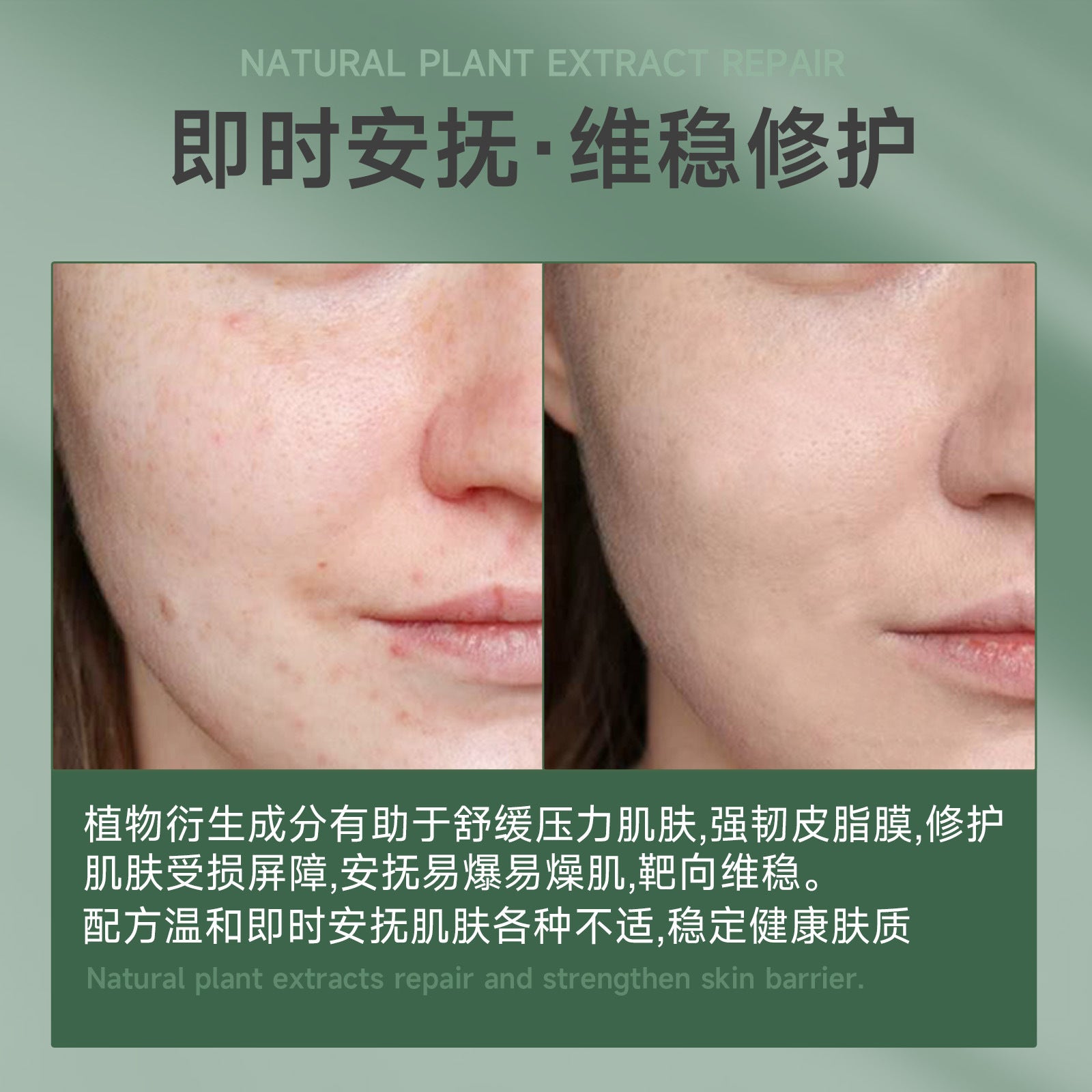 SHELOVES Centella Asiatica Essence Stick Soothing After-Sun Redness Sensitive Cooling Ice Hydrating No-Wash Essence Stick