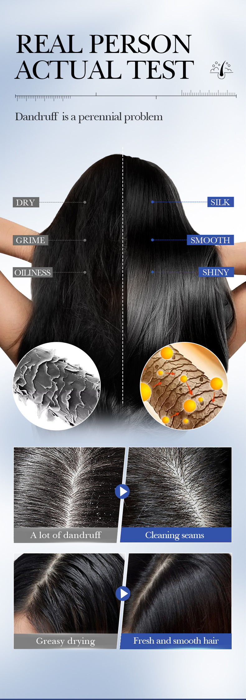 Cross-border Selenium Disulfide Anti-Dandruff Shampoo400ml Deep Cleansing and Moisturizing Shampoo Export Manufacturer Wholesale