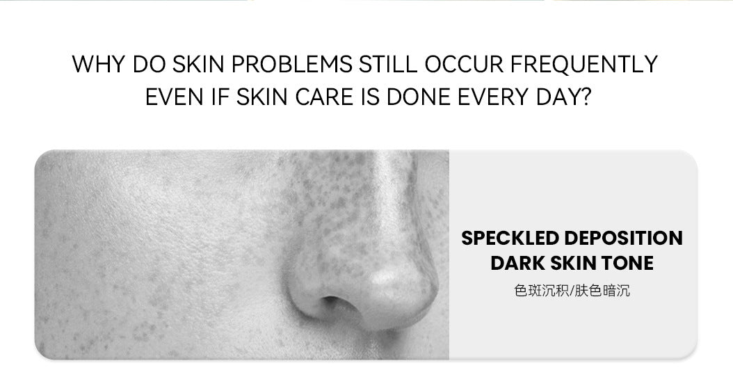 Exclusive for 7%Glycolic Acid Lotion Glycolic acid toner Fruit Acid Exfoliating Skincare