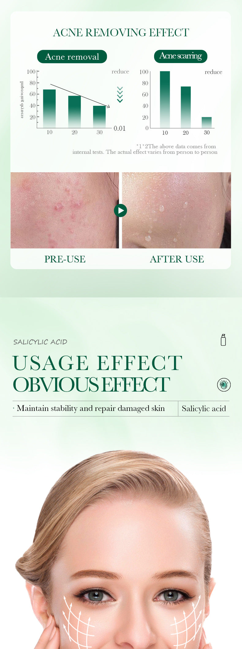 Full English Salicylic Acid Skincare Series SADOER Anti-acne Amino Acid Moisturizing and Hydrating Skin Care Products  Foreign Trade Approval