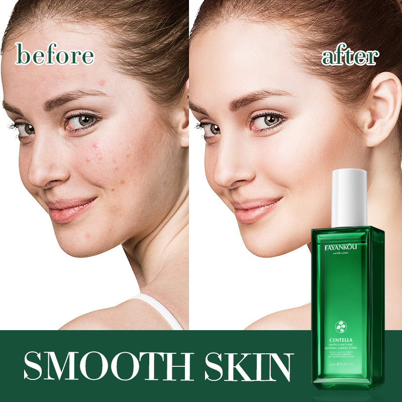 Centella Asiatica Soothing Essence Water FAYANKOU Moisturizing and Hydrating Water Wholesale for Cross-Border Trade