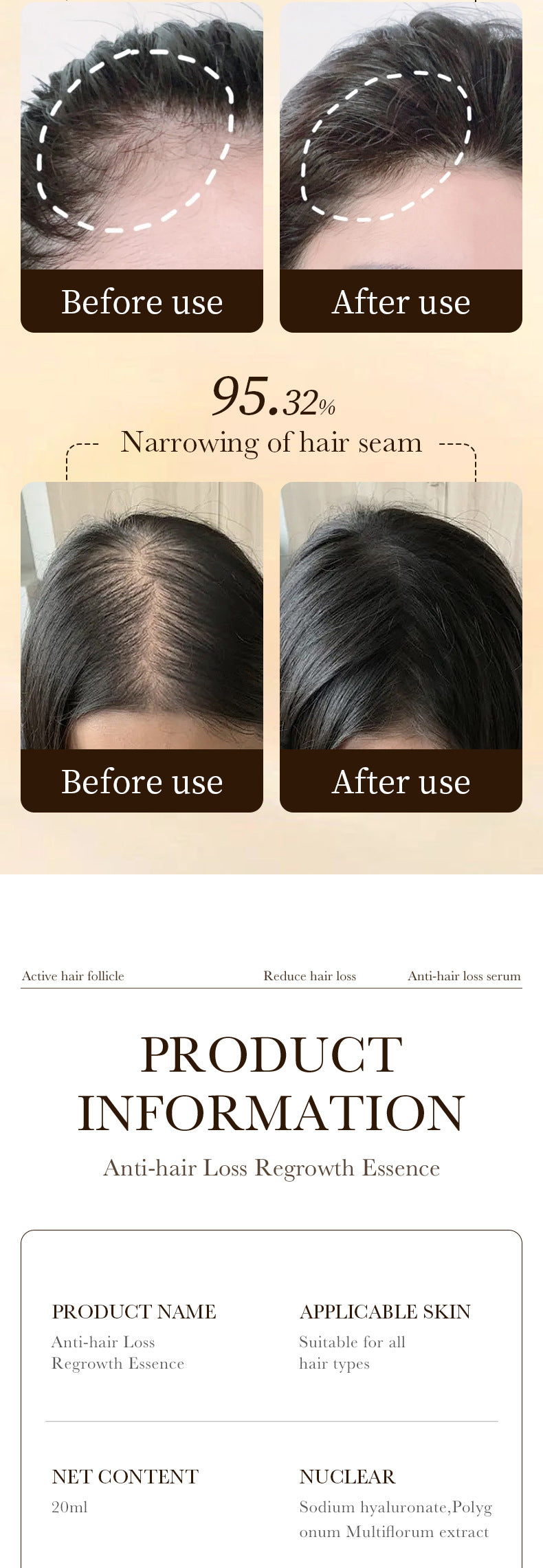 Full English Anti-Hair Loss Serum ZOZU Strengthen Hair Roots Improve Hair Loss Hair Growth Essence  Wholesale