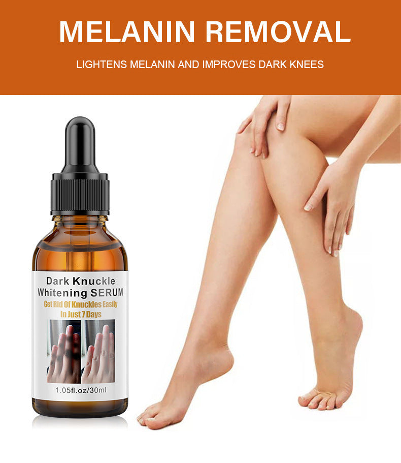 Joint Darkening Essence for Knees and Ankles, Brightens Skin Tone and Reduces Spots Full Coverage Dark Spot Removal Essence