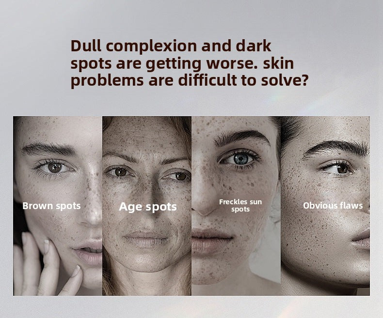 Niacinamide Whitening and Spot Removal Cream Brightening Moisturizing Fade Pigmentation Melasma Hydrating Face Cream Skincare