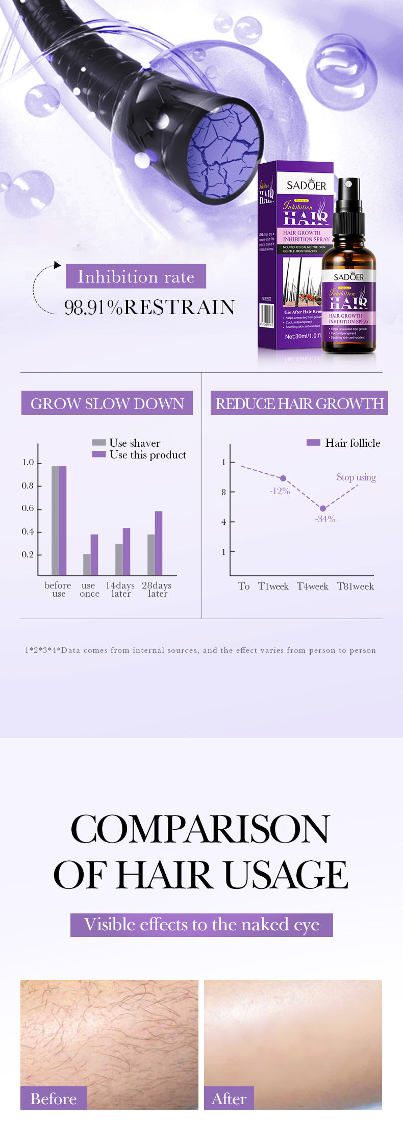 Full English Hair Growth Inhibitor Spray SADOER Inhibiting Underarm and Leg Hair Spray  Wholesale