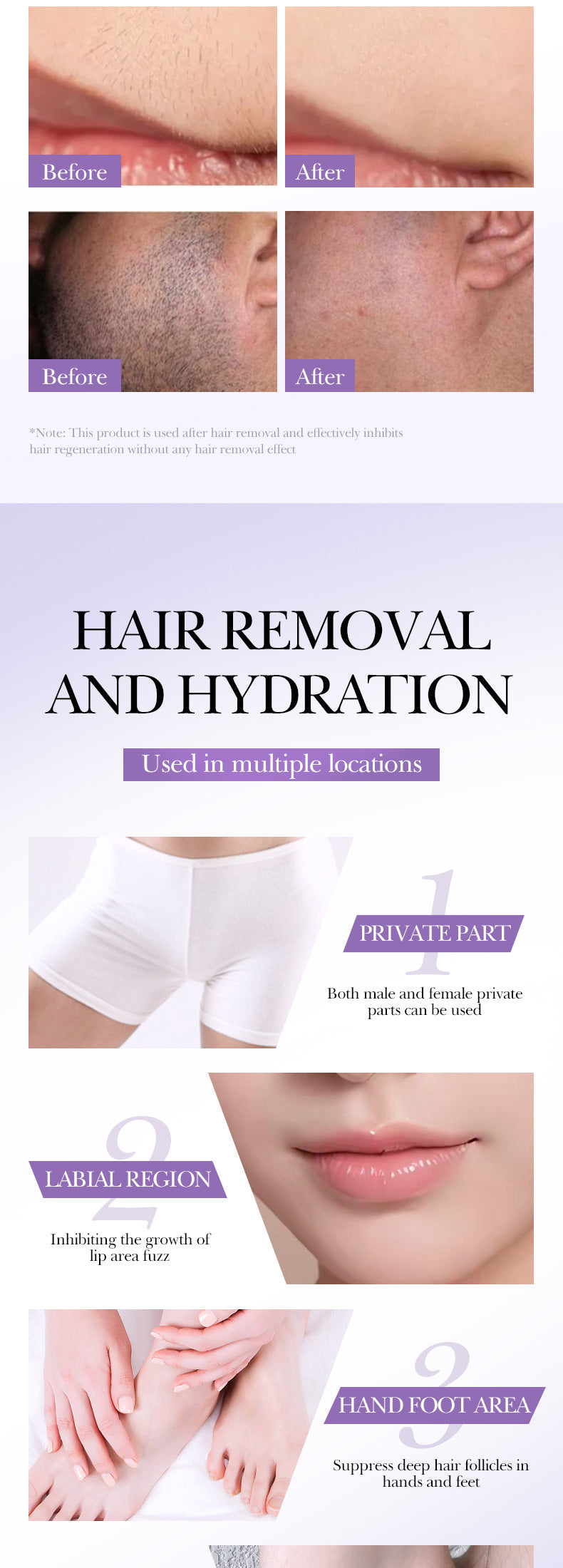 Full English Hair Growth Inhibitor Spray SADOER Inhibiting Underarm and Leg Hair Spray  Wholesale