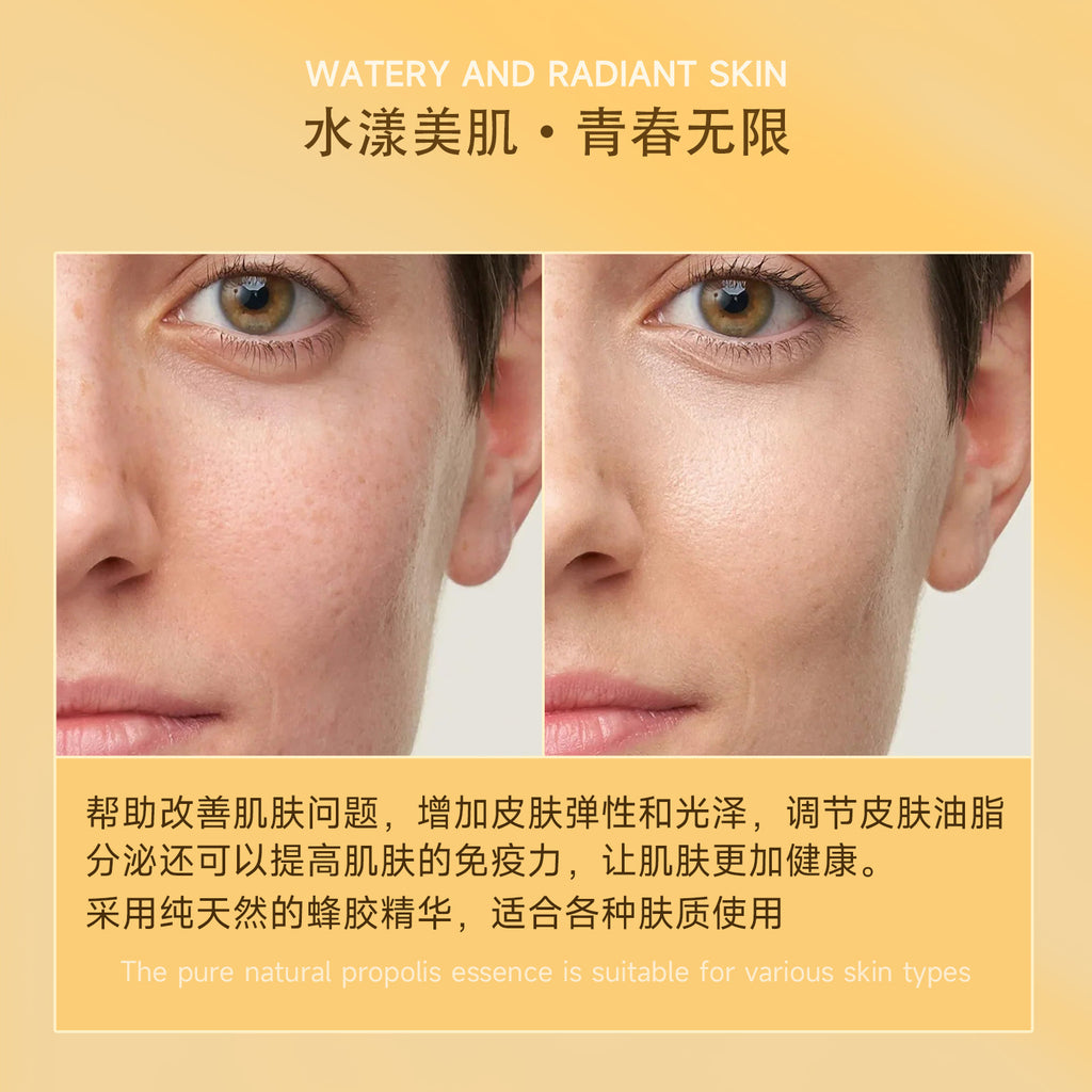 SHELOVES Propolis Anti-Wrinkle Essence Stick, Wrinkle-Reducing Stick, Neck Wrinkle, Eye Area Wrinkle Smoothing, Moisturizing, Skin Rejuvenation, Hydrating Stick