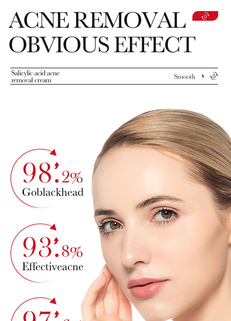 Full English Cream BIOAOUA Salicylic Acid Moisturizing Hydrating Fading Acne Marks  Wholesale