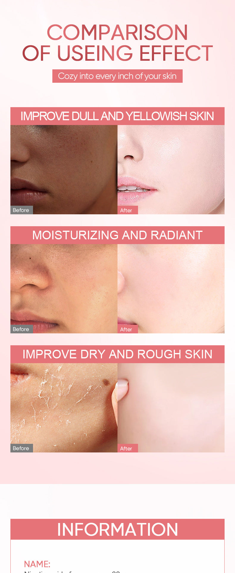 Niacinamide Skin Rejuvenation Cream BIOAOUA Hydrating Moisturizing Hydrating Moisturizing Cream Cross-Border Foreign Trade Wholesale