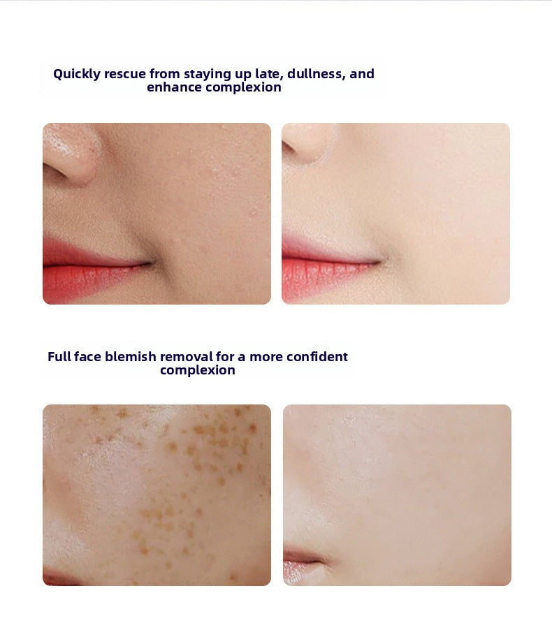 Yuejin Photon Bottle Niacinamide377Whitening and Anti-freckle Essence Facial Skin Care Moisturizing Set Brightening Skin