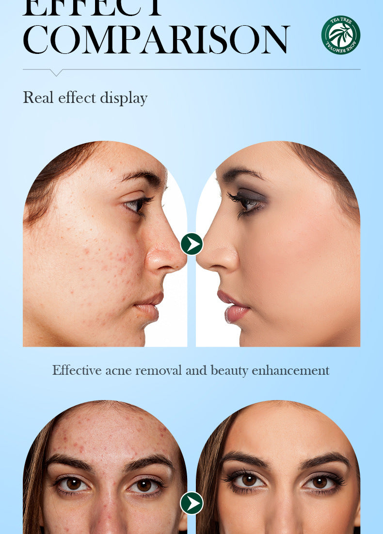 Full English Tea Tree Skincare Set SADOER Cleansing, moisturizing, hydrating five-piece set for  foreign trade wholesale