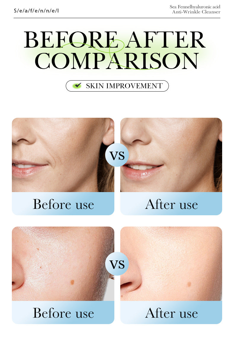 Sea Fennel Hyaluronic Acid Skin Care Set  BIOAOUA Moisturizing Five-Piece Set Cross-Border Wholesale