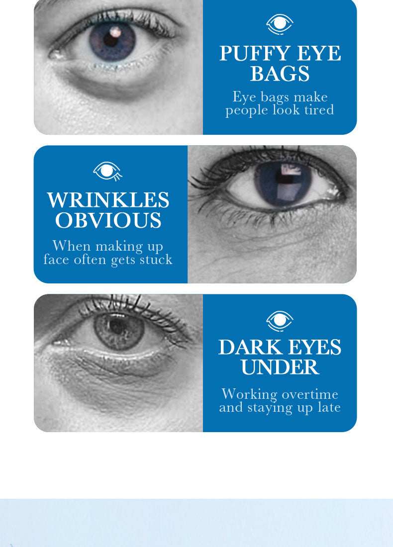 Collagen Butterfly Gel Eye Mask SADOER Improve Dark Circles and Eye Wrinkles Cross-Border Wholesale