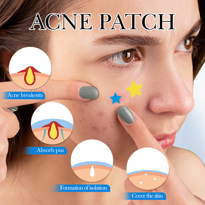 Acne patch SADOER Acne Removal and Repair Patch Colorful Student Acne Treatment Cross-Border Foreign Trade Factory Direct Sales