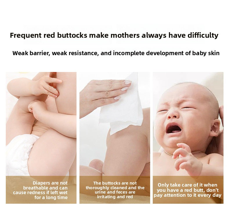 ukepoe Baby Diaper Rash Cream Newborn Red PP Care Processing Improve Butt Redness Baby Diaper Rash Cream OEM